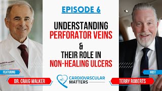 Ep. 6 - Understanding Perforator Veins and Their Role in Non-Healing Ulcers