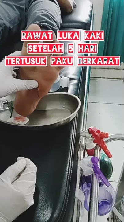 Rawat Luka Tertusuk Paku Berkarat | setelah 5 hari luka #shorts
