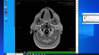 Remote Radiology VPN Showdown | Zscaler screenshot 5
