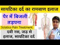 Sciatica       sciatica pain causes symptoms  treatment