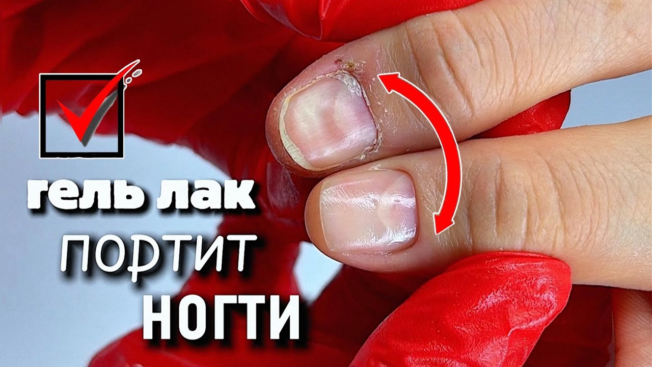 гель лак ПОРТИТ ногти? через месяц результат 🤯