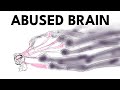 Understanding the Impact of Abuse on the Brain