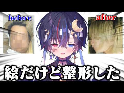 絵が300万かけて骨切ってきた。