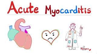 Acute Myocarditis — Causes, Symptoms, Diagnosis & Treatment — Cardiology