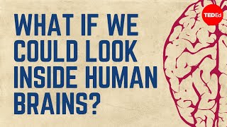 What if we could look inside human brains? - Moran Cerf