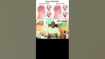 lantana camara mulungi kuba stroke nokusanyalala
