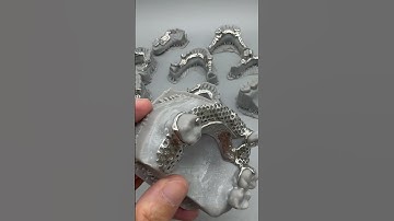 3D Metal printing framework Co-Cr & Titanium (design + print + polish)
