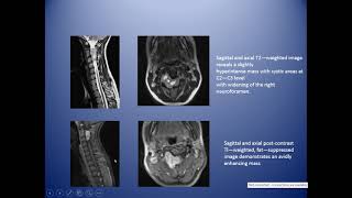 Spinal pathology screenshot 5