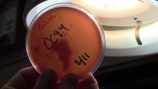 Innovative Testing Technology at San Francisco's Public Health Lab