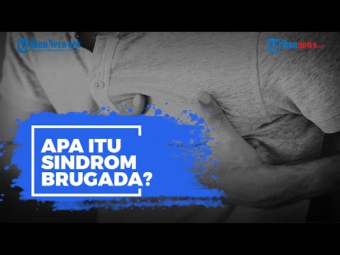 Video: Sindrom Brugada: Apa Artinya, Penyebab, Perawatan, Dan Lainnya