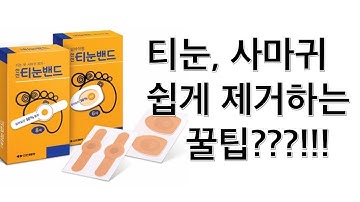 티눈, 사마귀 쉽게 제거 하는 꿀팁 (병원가서 냉동, 레이저 치료 전에 시도 해보세요!)