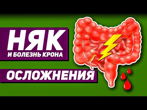 Как кишечник влияет