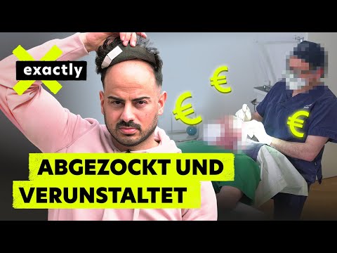 Pfusch und Betrug: Das Geschäft mit dem Haarausfall | Doku