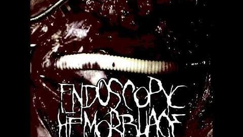 Endoscopyc Hemorrhage - Bizarre Thoughts Horrificly Conceived (alternate version)