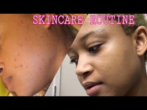 SKINCARE ROUTINE: how to get rid of dark spot  with baking soda (Creole/English)
