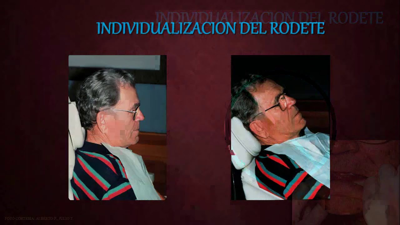 PLACA BASE, RODETES DE CERA Y PRUEBA DE ENFILADO