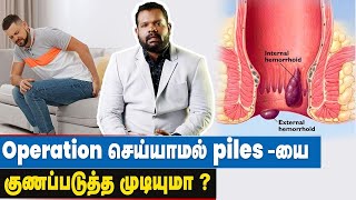 மூல நோய், காரணமும் தீர்வும் | Piles Treatment in Tamil | Precautions for Piles | Types of Piles