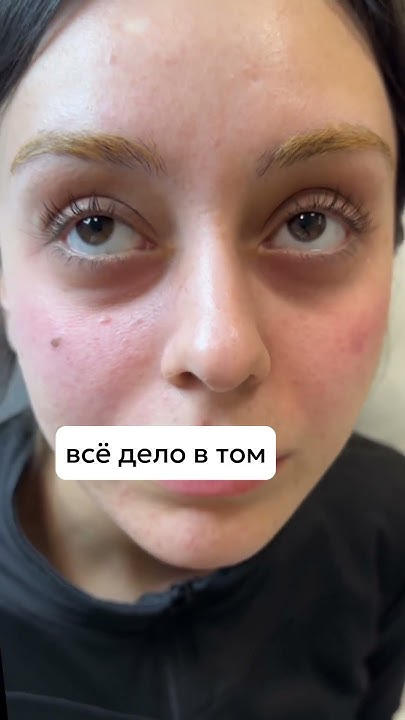 «У меня мешки под глазами, как у панды😢🐼». Как скорректировать эти ...