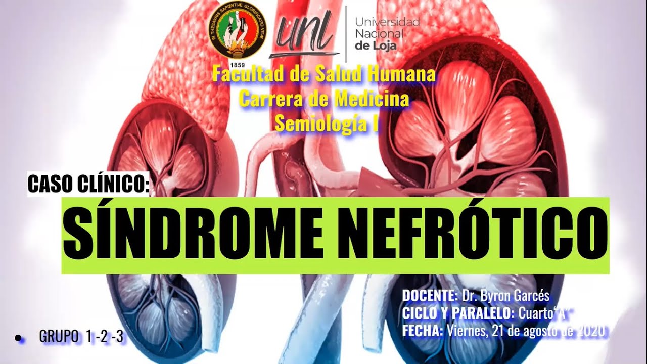 Caso clínico Síndrome Nefrótico YouTube