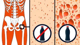 Vücudunuza Zarar Verebi̇lecek 9 Yi̇yecek