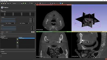 B4D Guide Module- 3D Slicer- Rotating a Dicom