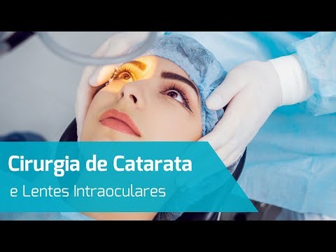 Cirurgia de Catarata
