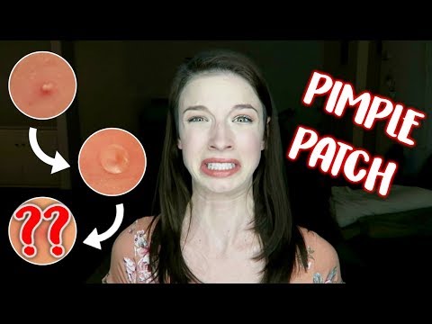 PIMPLE PATCH STICKERS | Does it Dance?