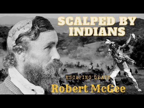 SURVIVING A SCALPING: How Robert McGee and others survived Indian attacks and lost their scalps.