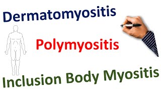 Dermatomyositis Polymyositis Inclusion Body Myositis| STEP NCLEX COMLEX