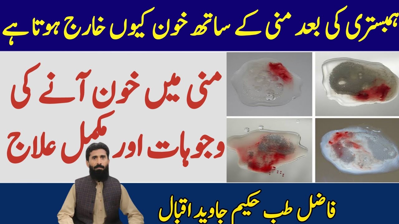 Mani Mein Khoon Aana Blood in Semen Discharge Ke Sath Blood Aana