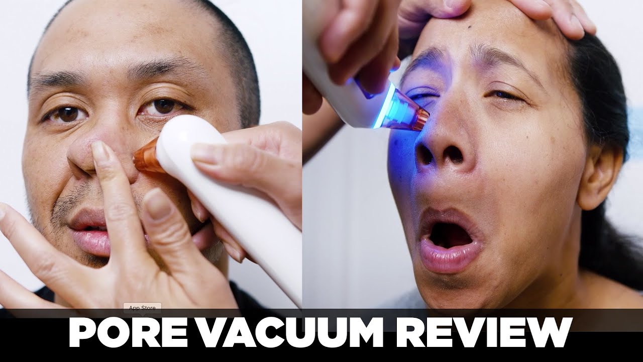 AMAZON BLACKHEAD VACUUM REVIEW | DO THEY WORK?