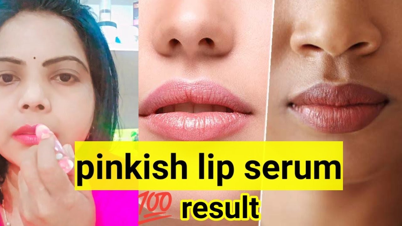 How to get pink lipsRemove dark lipslightening dark lipslip serum byApple beauty YouTube