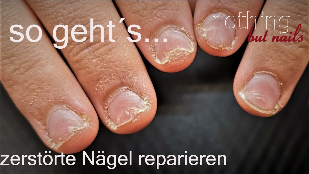 zerstorte nagel reparieren naildesign nails youtube acrylnagelformen perfekte 