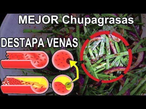 <strong>Esta</strong> Comida es la MEJOR Chupagrasas de VENAS,ARTERIAS y CORAZÓN (Receta <strong>super</strong> Fácil)