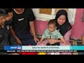 Selama 8 Bulan, Balita Ini Derita Stunting dan TBC yang Mengerikan