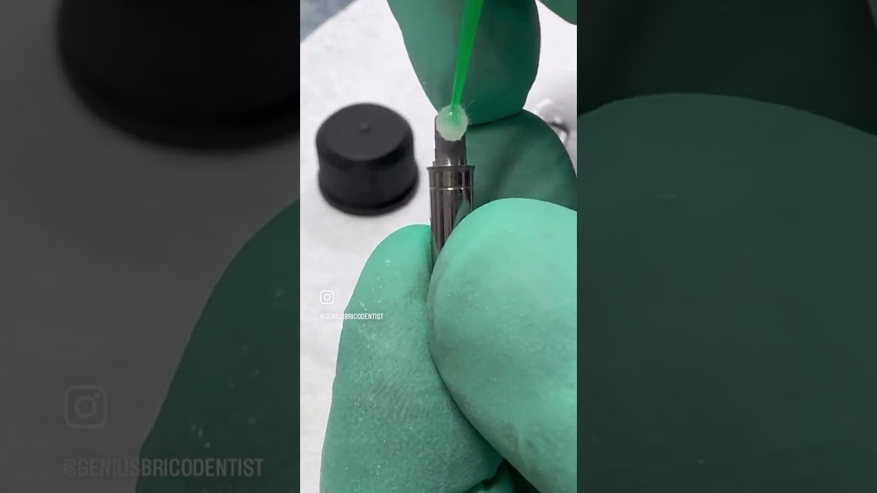 Collage d un tibase sur une couronne en zircone#dentist #digitaldentistry #zirconia #dragonballz