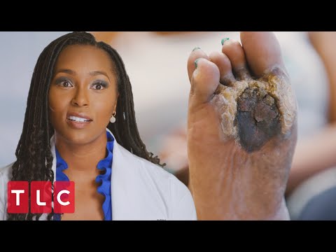 “Cursed Foot” Leaves Dr. Ebonie Stunned | My Feet Are Killing Me