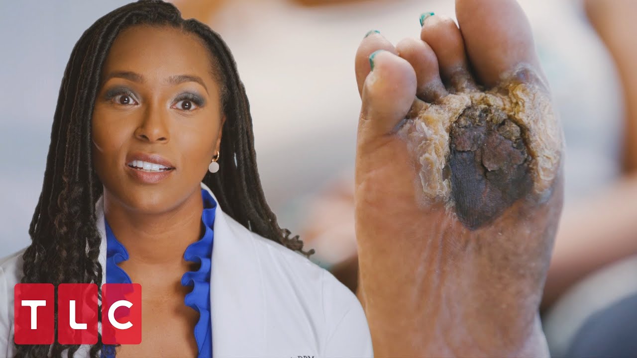 “Cursed Foot” Leaves Dr. Ebonie Stunned | My Feet Are Killing Me