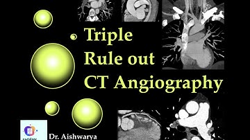 TRIPLE RULE OUT CT ANGIOGRAPHY l Radiology explained. Radiology defined.