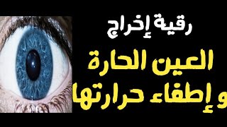 رقية لإخراج العيون الحارة المؤذية و إطفاء حرارة الحسد و العين