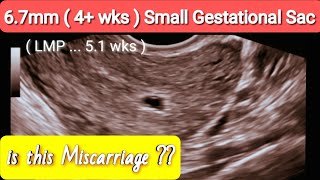Early Pregnancy 4+wks Ultrasound , with [ LMP 5.1 wks ]  What to do !!