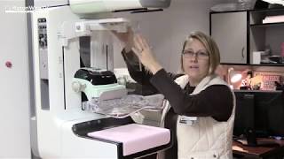 2018 Fund An Item Selenia Dimensions 3D Mammography System (2nd version)