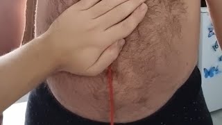 Noisy Stomach Sounds With Burps While Drinking And Standing