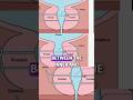 Understanding the UroLift Procedure: Your Questions Answered #shorts