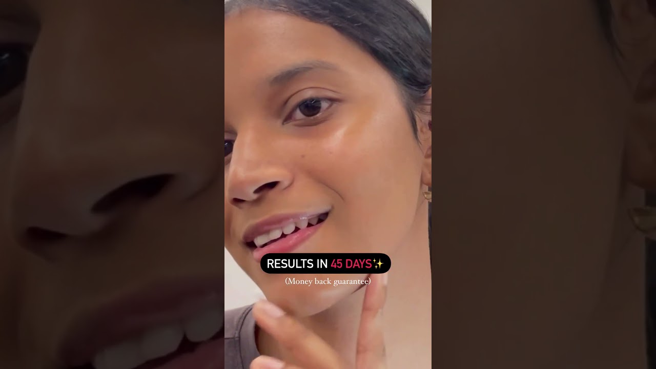 Anti Pigmentation Serum For Even and Brighter Skin | Serum to Fade Acne spots, & Age spots