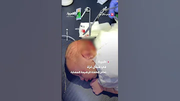 طفلة عمرها ساعات أصابها القصف على شمال القطاع في رأسها 