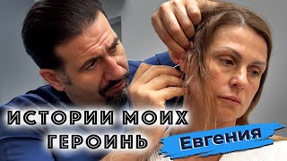 Истории моих героинь: Евгения,  омоложение лица