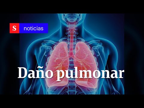¿Qué daño causa en los pulmones la covid-19? | Semana Tv