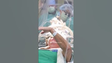 Its called deep brain stimulation (DBS)#parkinsons #parkinson #neurology #medical #doctor