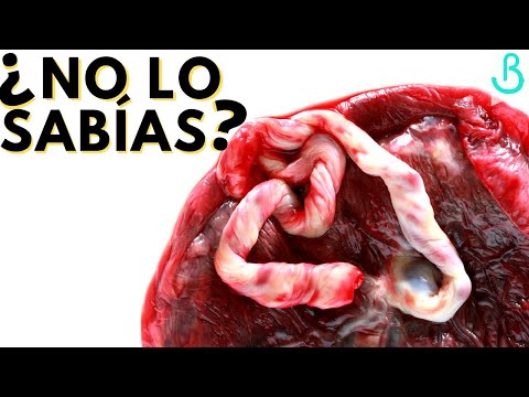 Video: Cómo lidiar con la placenta previa (con imágenes)